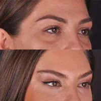 اقساط 24 ماهه جراحی ها فقط با جراحان پلاستیک درجه1|خدمات آرایشگری و زیبایی|تهران, محمودیه|دیوار