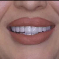 خدمات دندانپزشکی با شرایط ویژه|خدمات آرایشگری و زیبایی|زنجان, |دیوار