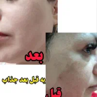 کرم ضد لک لاکچری کوین برند فرانسه
