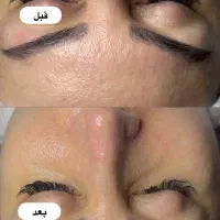 فشیال و میکاپ VIP با تخفیف محدود