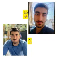 سرم فرمینو حجم دهی بدن و صورت|آرایشی، بهداشتی، درمانی|تهران, تهران‌نو|دیوار