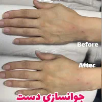 مزو،بوتاکس،چربی،فیلر،جراحی زیبایی صورت وبدن|خدمات آرایشگری و زیبایی|تهران, نارمک|دیوار
