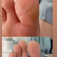 پدیکور  حرفه ای در مهاباد