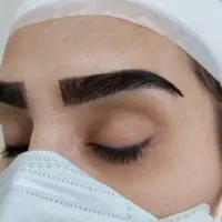 کاشت مو ابرو ریش vip
