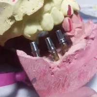 نیروی جوان برای لابراتوار دندانسازی نیازمندیم