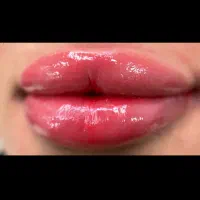فرصت ویژه