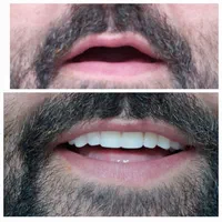 دندان مصنوعی|آرایشی، بهداشتی، درمانی|کاشان, راه آهن کاشان|دیوار