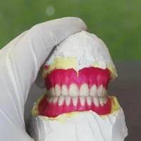 دندانسازی دندان مصنوعی با پرداخت اقساطی