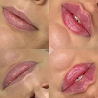 خدمات زیبایی ژل و بوتاکس