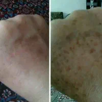 ارایشی بهداشتی