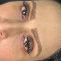 کاشت مژه هیدن