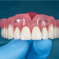 دندان مصنوعی با تعرفه دولتی و اقساط