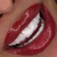 کامپوزیت دندان سارمکو کاریزما ای پی اس|خدمات زیبایی و سلامت|تهران, نارمک جنوبی|دیوار