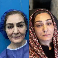 فروش ژل بوتاکس نخ و لوازم بهداشتی کلینیک  زیبایی|خدمات آرایشگری و زیبایی|تهران, قیطریه|دیوار