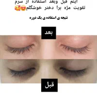 راه طبیعی رشد ابرو و مژه|آرایشی، بهداشتی، درمانی|تربت جام, امام|دیوار