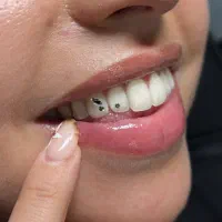 مدل برای کاشت نگین دندون و پیرسینگ