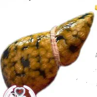 عاشق کبدت باش