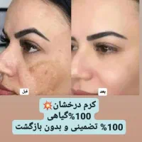 کرم انحصاری درخشان کاملا گیاهی و بدون بازگشت
