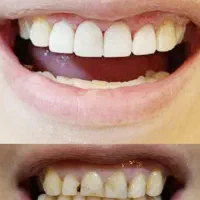 دندانپزشکی دکتر چراغی نقد و اقساط بدون سود