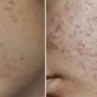 راهکار گیاهی سلامت بدن