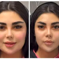 مرکز تخصصی فرم دهی و‌لیفت بینی و صورت با نخ و‌ژل|خدمات آرایشگری و زیبایی|مشهد, احمدآباد|دیوار