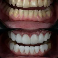 دندانپزشکی زیبایی|خدمات آرایشگری و زیبایی|تهران, ازگل|دیوار