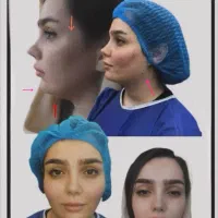 مرکز تخصصی تزریق فول فیس چربی و فیلر/لیفت با نخ|خدمات آرایشگری و زیبایی|مشهد, هنرستان|دیوار