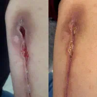 کلینیک تخصصی درمان انواع زخم(بستر و دیابت) فردوس|خدمات آرایشگری و زیبایی|اصفهان, محله سفلی|دیوار