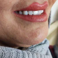 دندانسازی (فقط با ۱۵ میلیون )