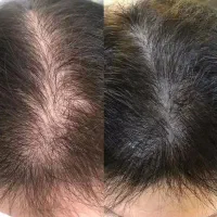 پش وای