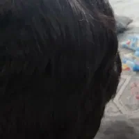 کلاه گیس