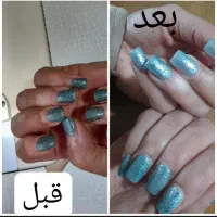 درمان معجزه گر|آرایشی، بهداشتی، درمانی|شاهینشهر, فردوسی|دیوار