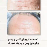 راه کار در منزل|آرایشی، بهداشتی، درمانی|لامرد, |دیوار