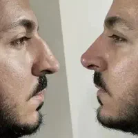 آفر ویژه خدمات زیبایی ژل فیلر بوتاکس لیفت|خدمات آرایشگری و زیبایی|شاهینشهر, طالقانی|دیوار