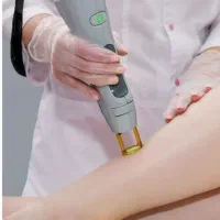 لیزر مو زائد فقط با ۵ جلسه