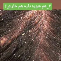 پاکسازی کف سر،درمان ریزش،شوره چربی سروضخیم سازی مو|خدمات آرایشگری و زیبایی|نیشابور, هفده شهریور|دیوار