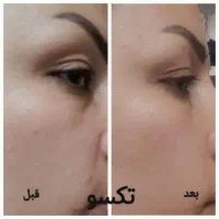 پوست ومو|آرایشی، بهداشتی، درمانی|قم, قم نو|دیوار
