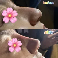 تزریق فیلر،ژل لب،فیلربینی|خدمات آرایشگری و زیبایی|شیراز, ریشمک|دیوار