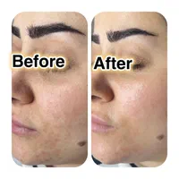 آموزش و خدمات پاکسازی پوست چالوس|خدمات آرایشگری و زیبایی|چالوس, |دیوار