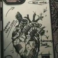 قاب نوت 11 پرو نو