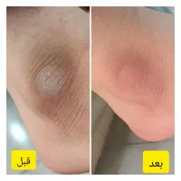پدیکور و کاشت مژه|خدمات آرایشگری و زیبایی|اهواز, منبع اب|دیوار