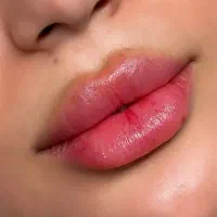 فیلر، بوتاکس فقط ۷۵۰ توسط پیراپزشک