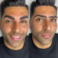 میکروبلیدینگ ابرو و بن مژه آقایان