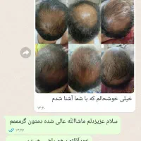 لاغری