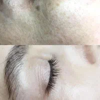 پاکسازی تخصصی پوست صورت|خدمات آرایشگری و زیبایی|اصفهان, فرح آباد|دیوار