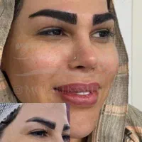کاشت ابرو تخصصی در درمانگاه معتبر|خدمات آرایشگری و زیبایی|اهواز, زیتون کارمندی|دیوار