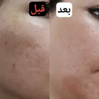 سرم جوانساز پوست شادابی و رفع چین و چروک