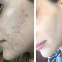 کرم سفید کنند وصابون|آرایشی، بهداشتی، درمانی|خاش, |دیوار