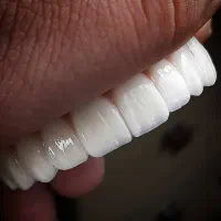 کاراموز دندانسازی