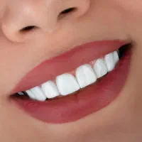 .عصب کشی 2500 . روکش 3 تومن . کاشت 10|خدمات زیبایی و سلامت|کرمانشاه, |دیوار
